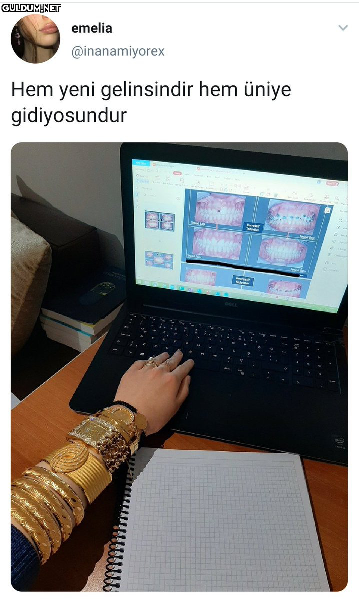 Hem de görmemişsindir  ...