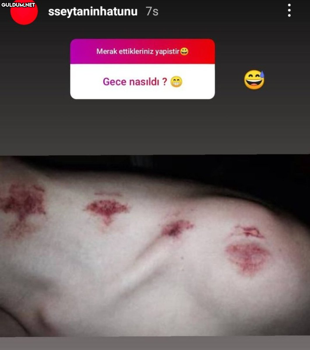 RT @ZkusagiZ: Ejderhayla...