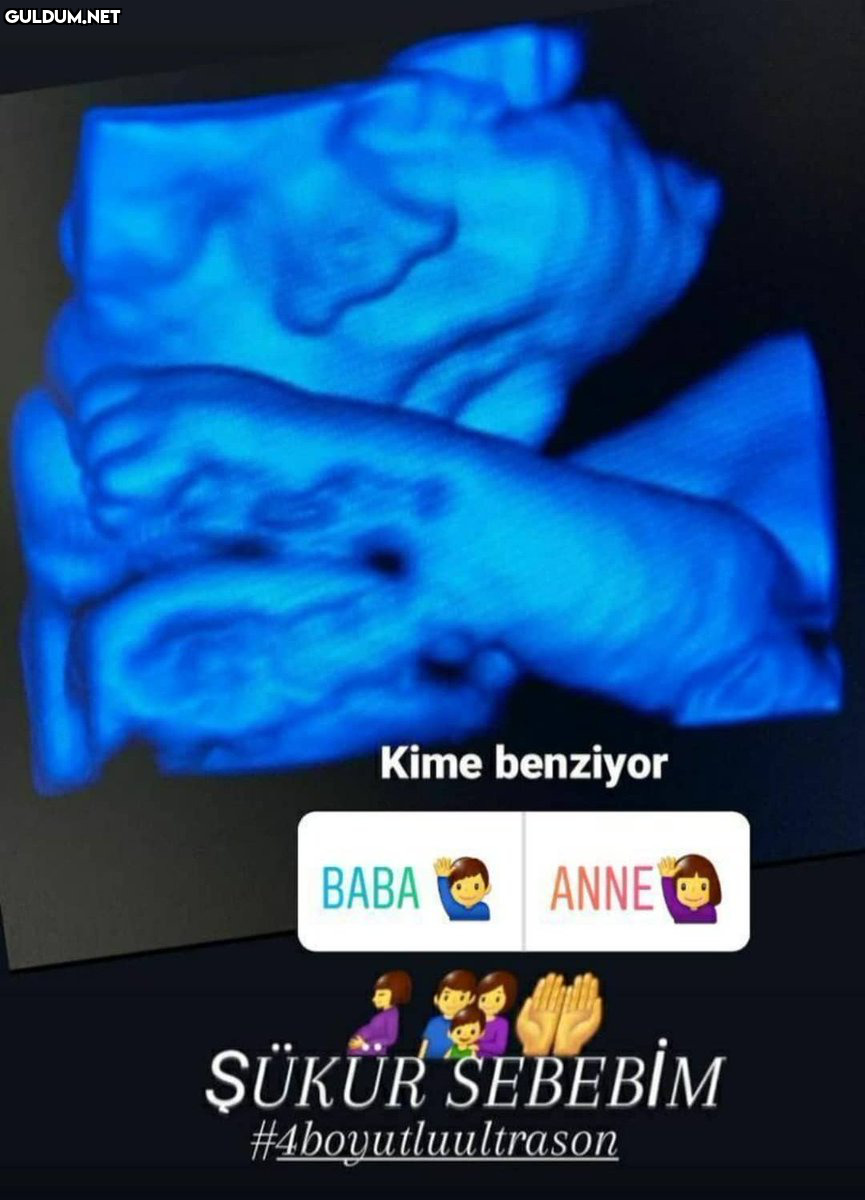 Fetüse benziyor   Kime...