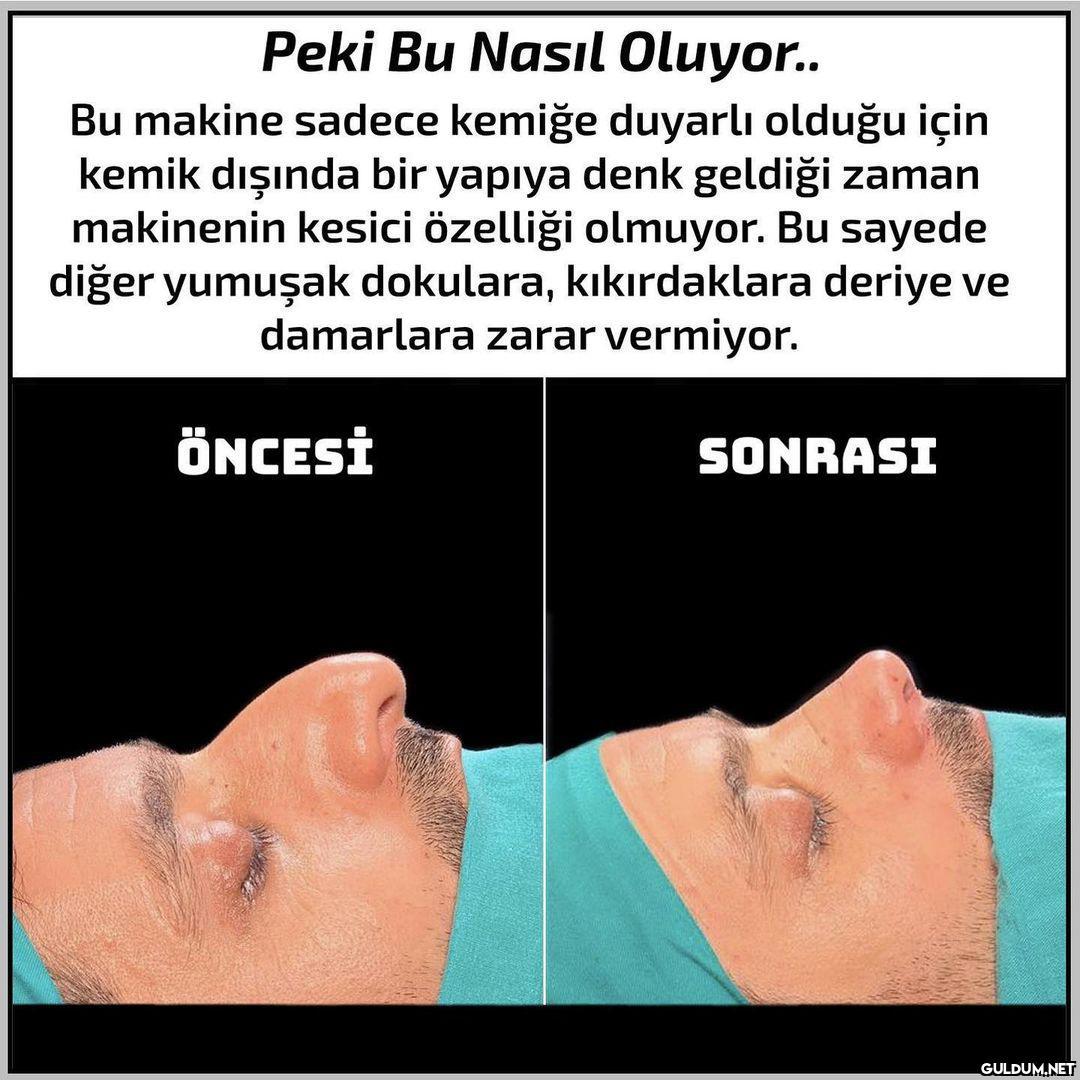 Arkadaşlar doktorun...