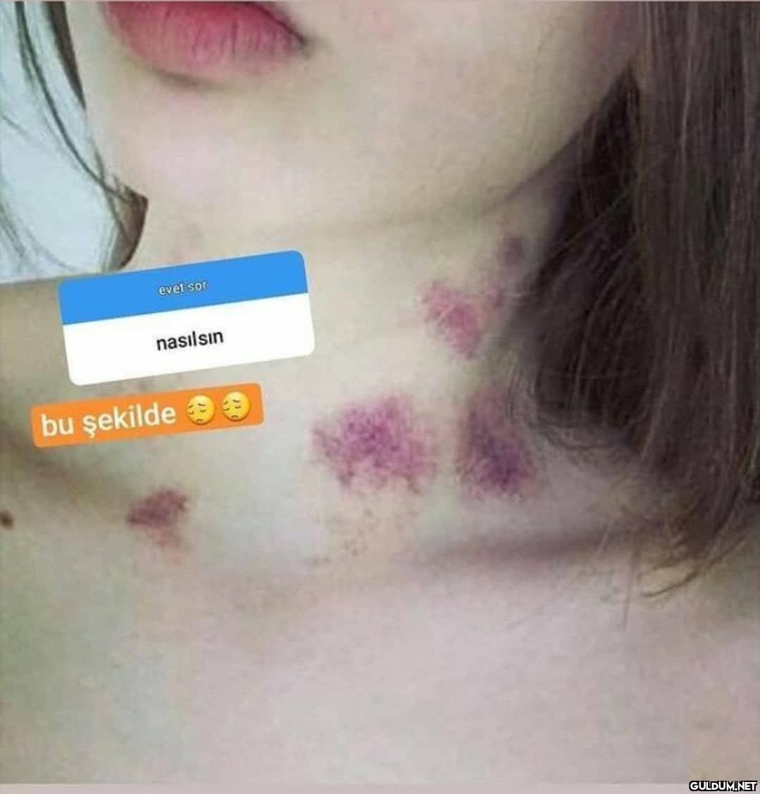 Savaş mı çıkmış    evet...