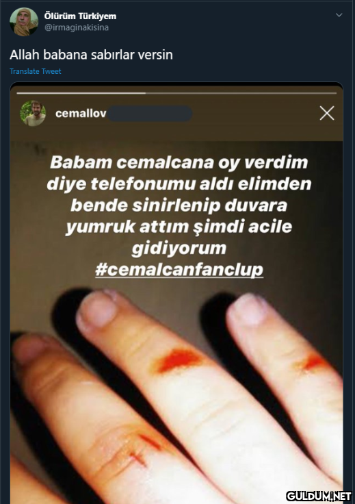 Ölürüm Türkiyem...