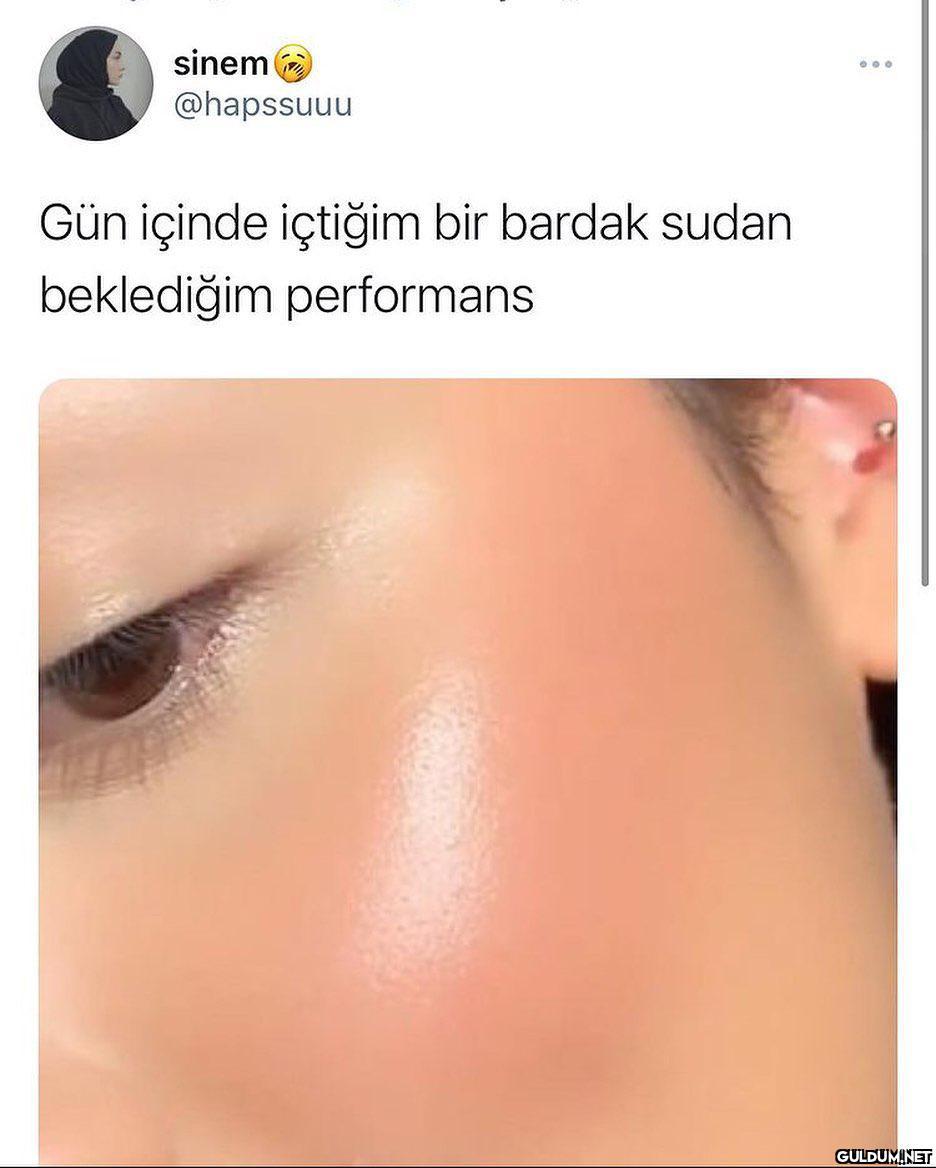 sinem @hapssuuu Gün içinde...