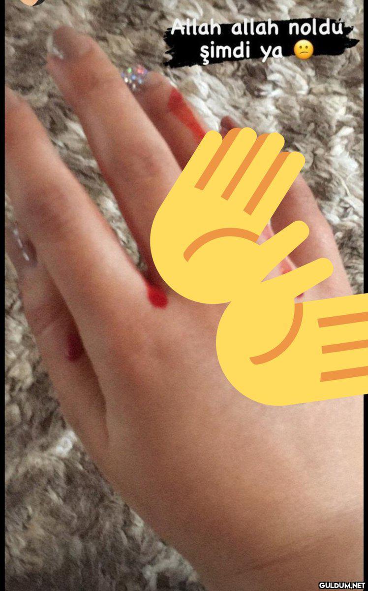 Abla her gün hasar kaydı...