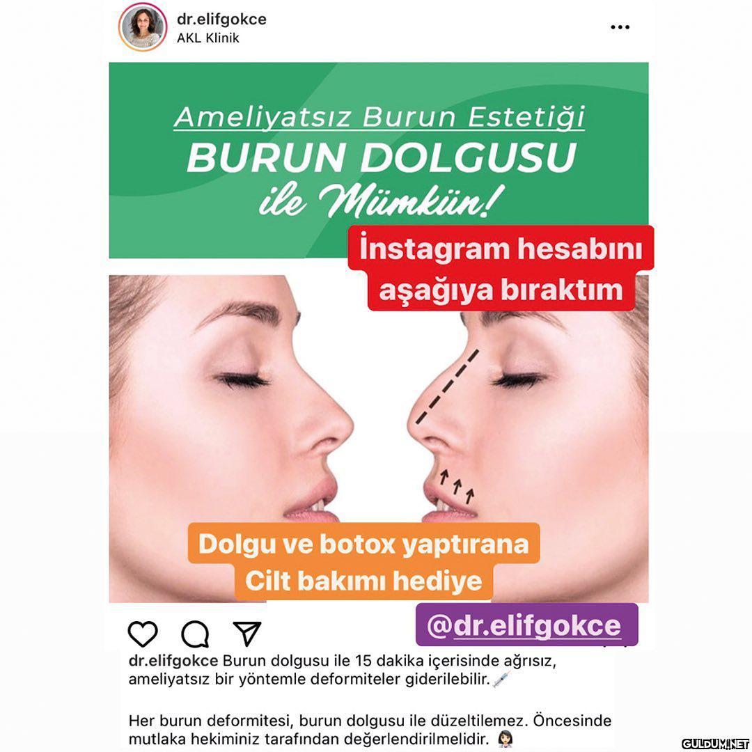 Dolgu ve botoks yaptırmayı...