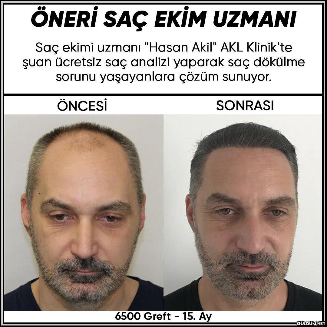 İnstası->...