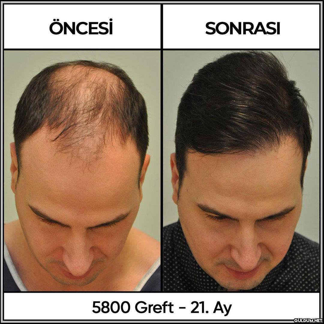 İnstası->...