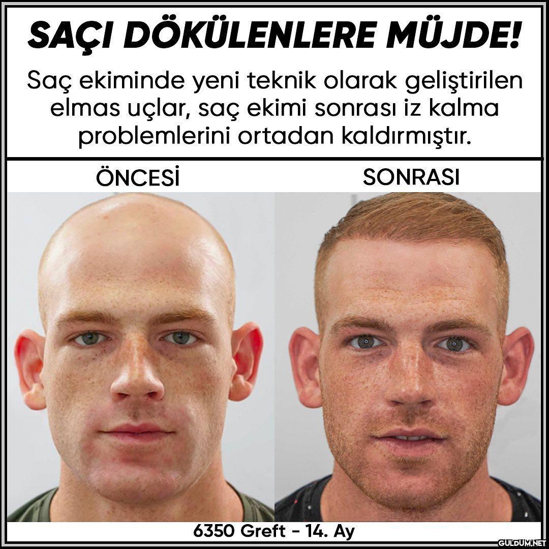 İnstası->...