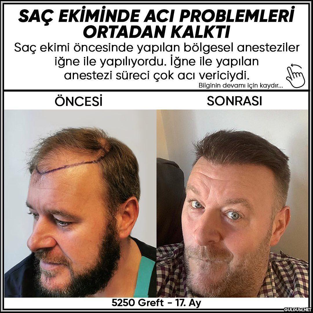 İnstası->...