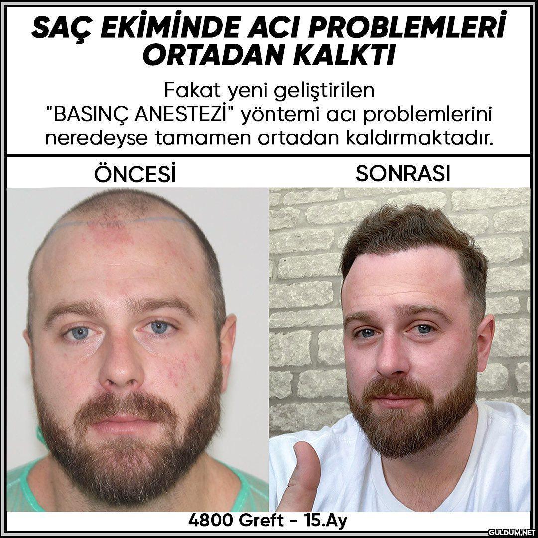 İnstası->...