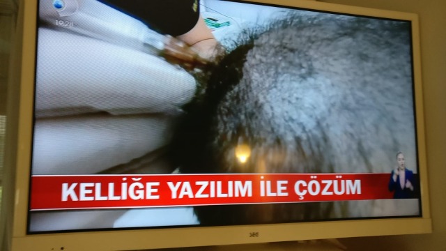 Kellige yazılım ile çözüm.