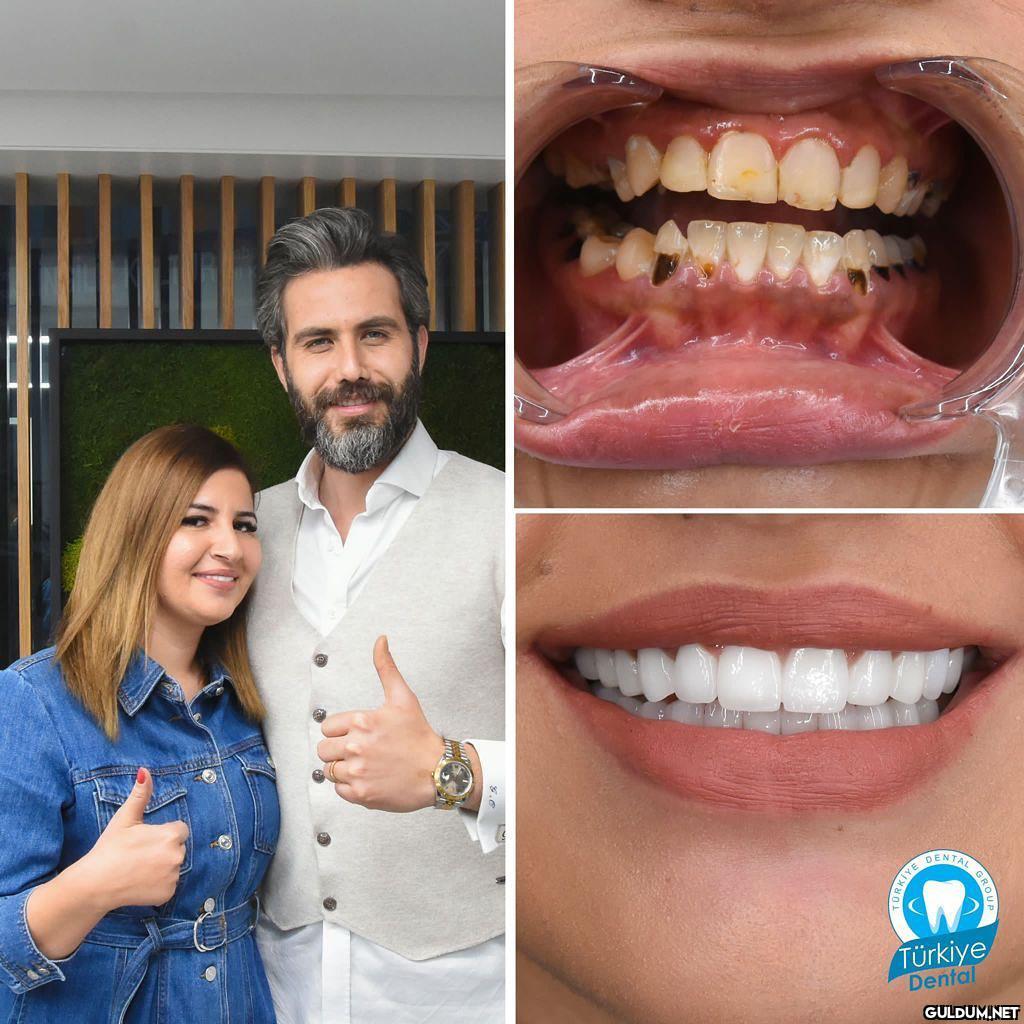 @turkeydental 👈...