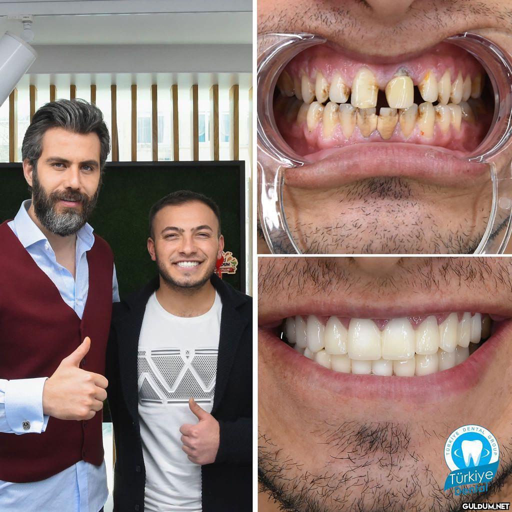 @turkeydental 👈...