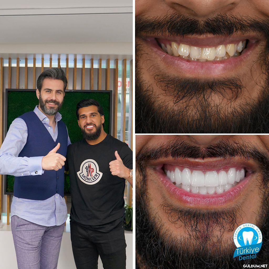 @turkeydental 👈...