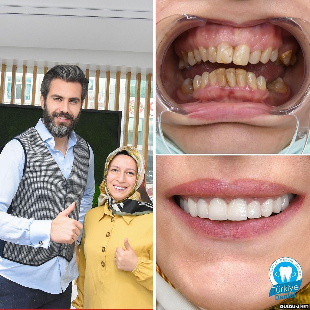 @turkeydental 👈...