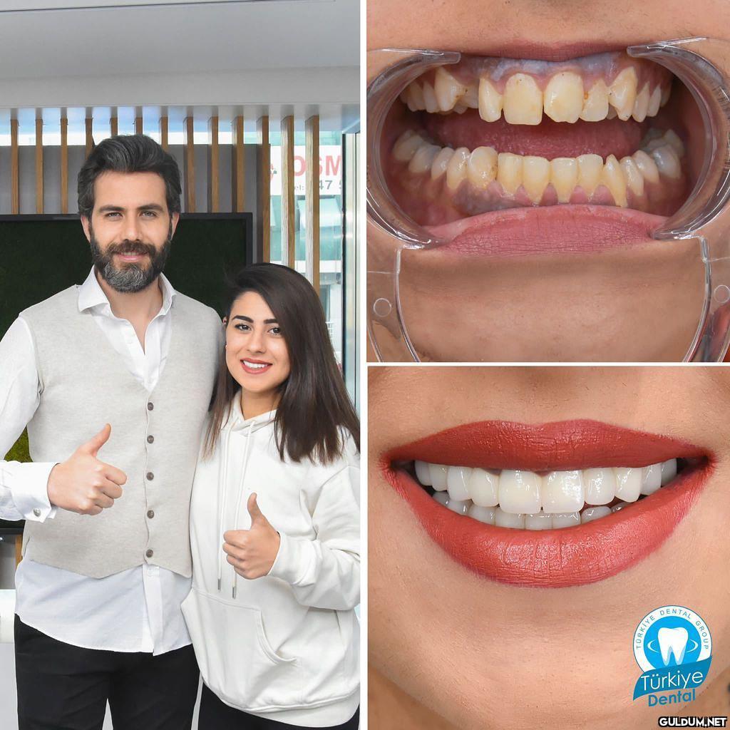 @turkeydental 👈...