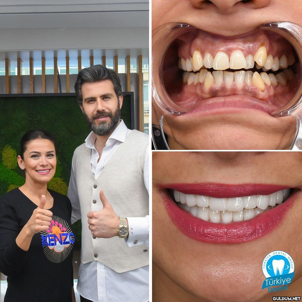 @turkeydental 👈...