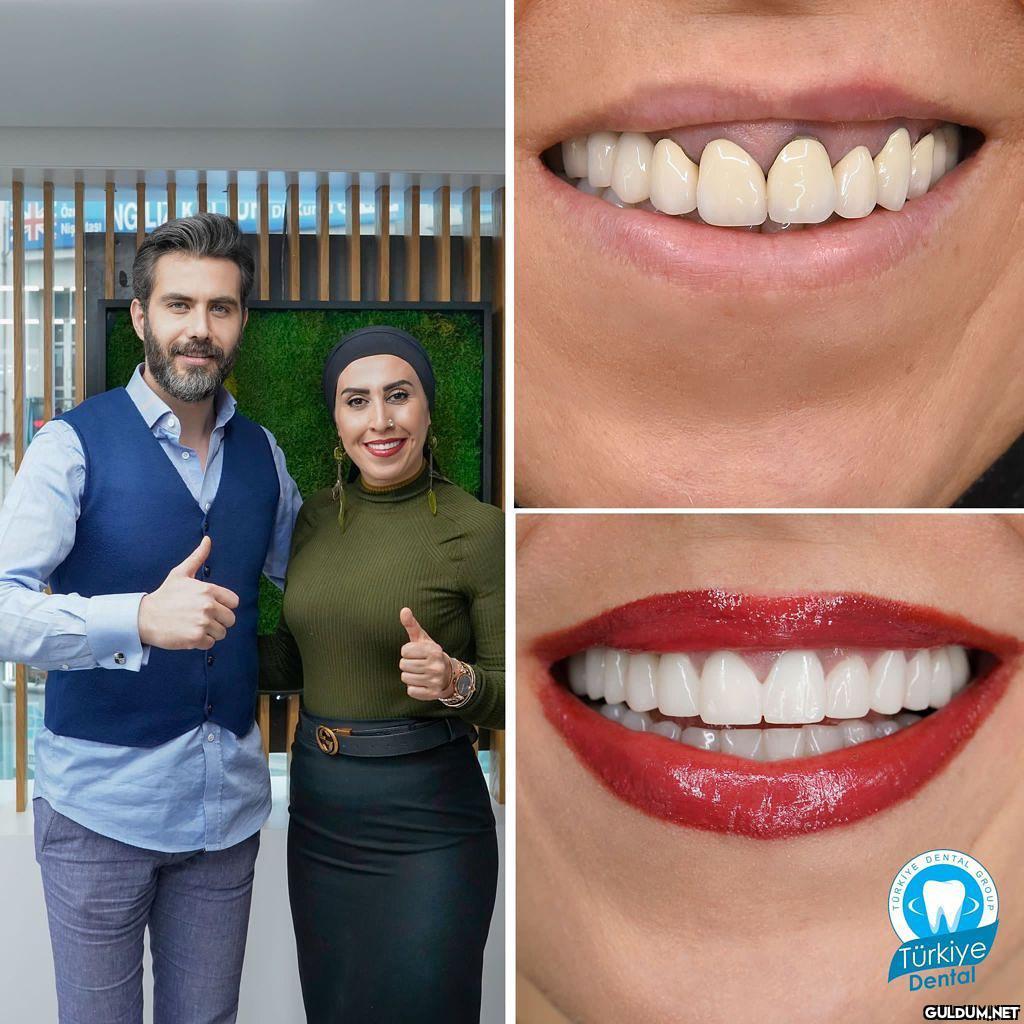 @turkeydental 👈...