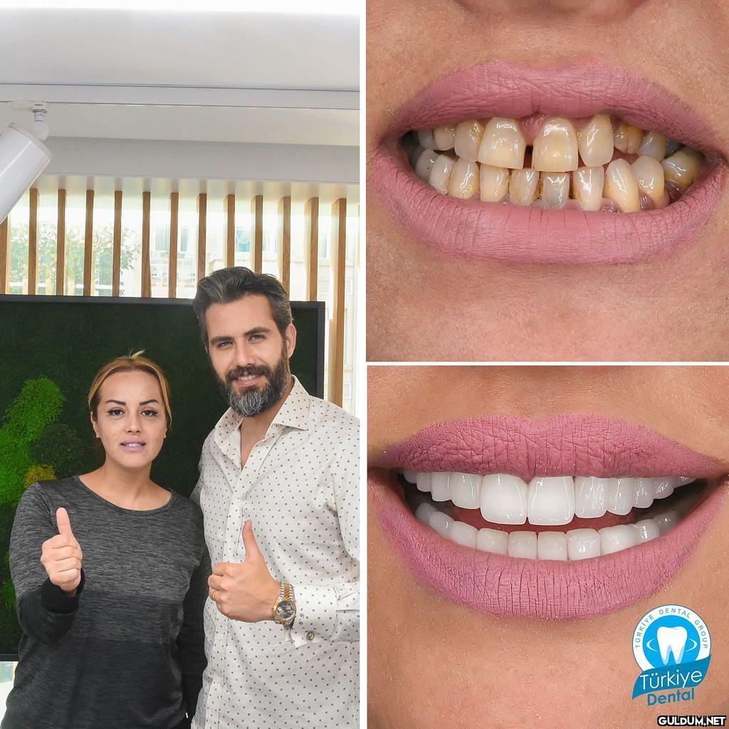 @turkeydental 👈...