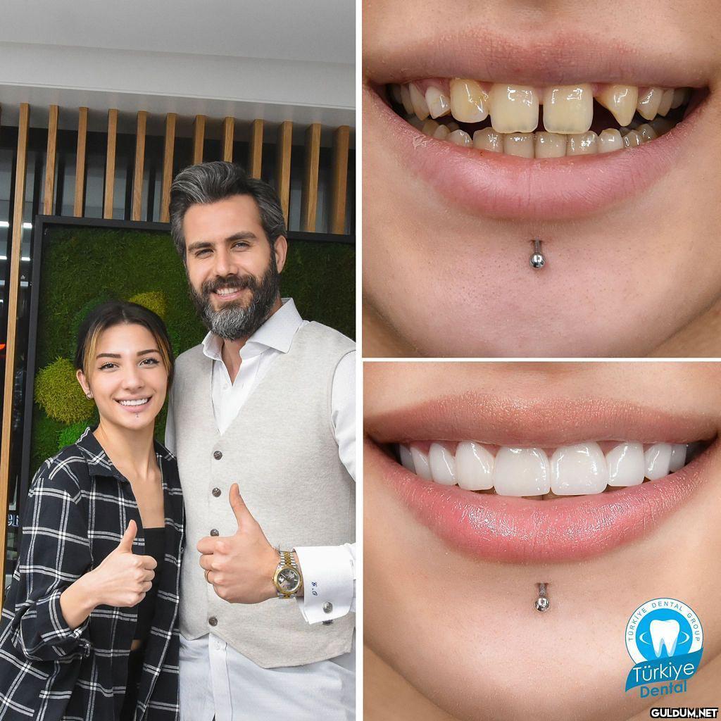 @turkeydental 👈...