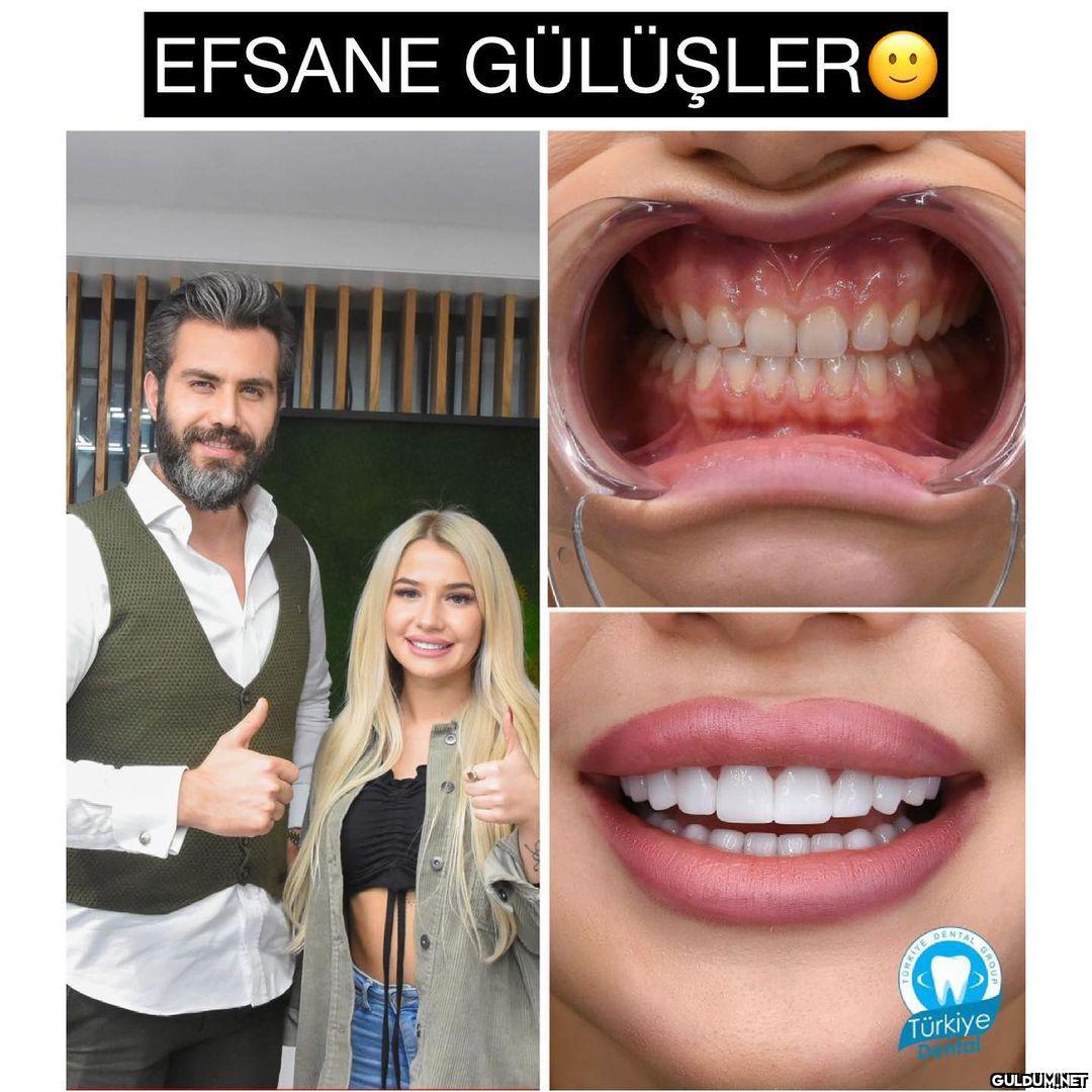 @turkeydental 👈...