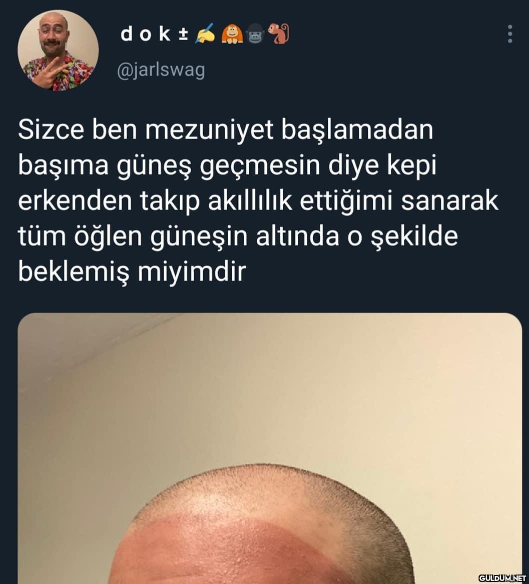 Renk geçişi çok iyi  dokt...