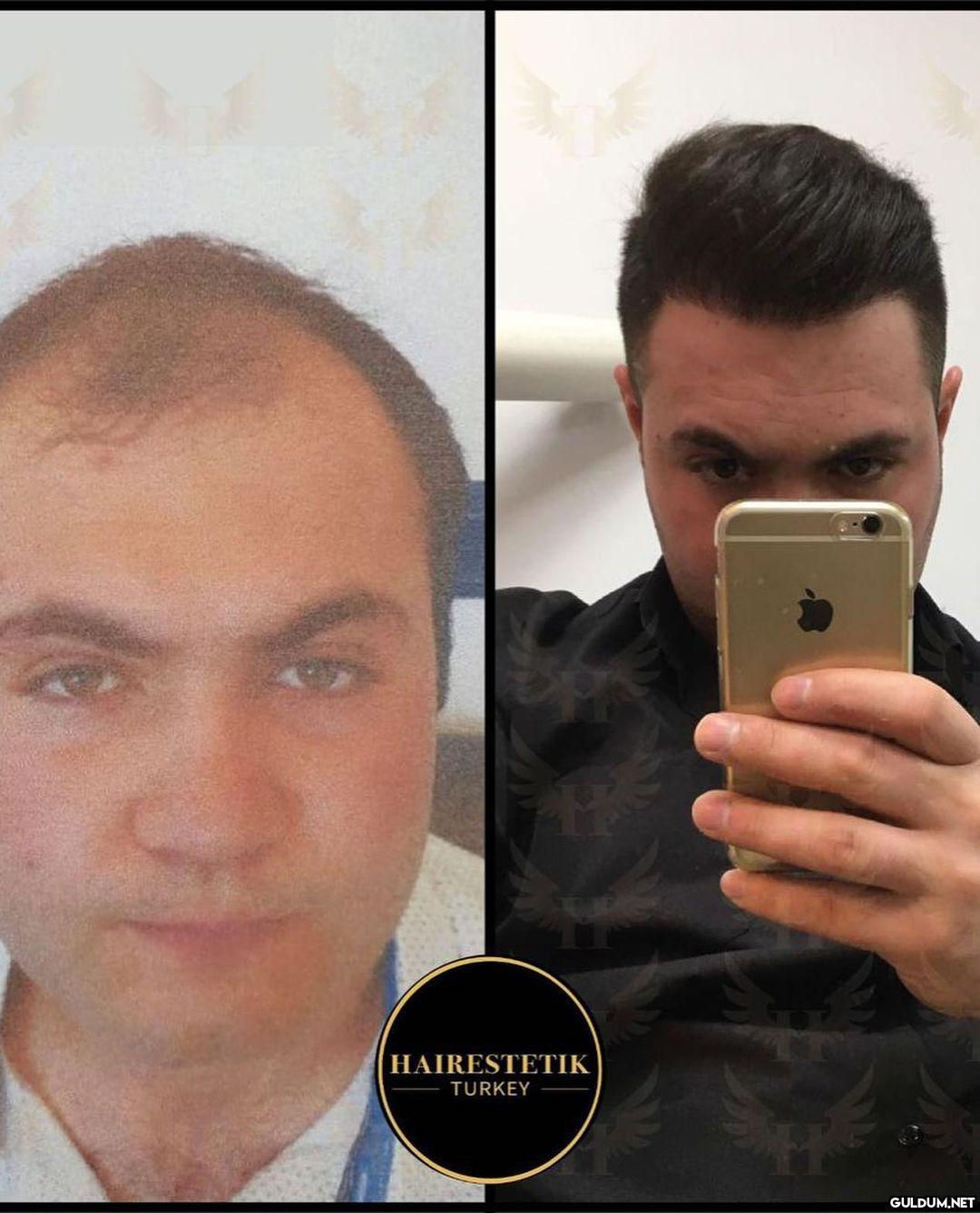 " @hairestetik Saphir Fue...