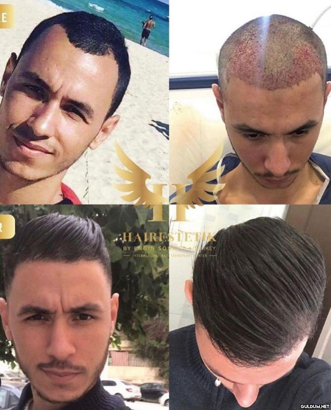 " @hairestetik Saphir Fue...