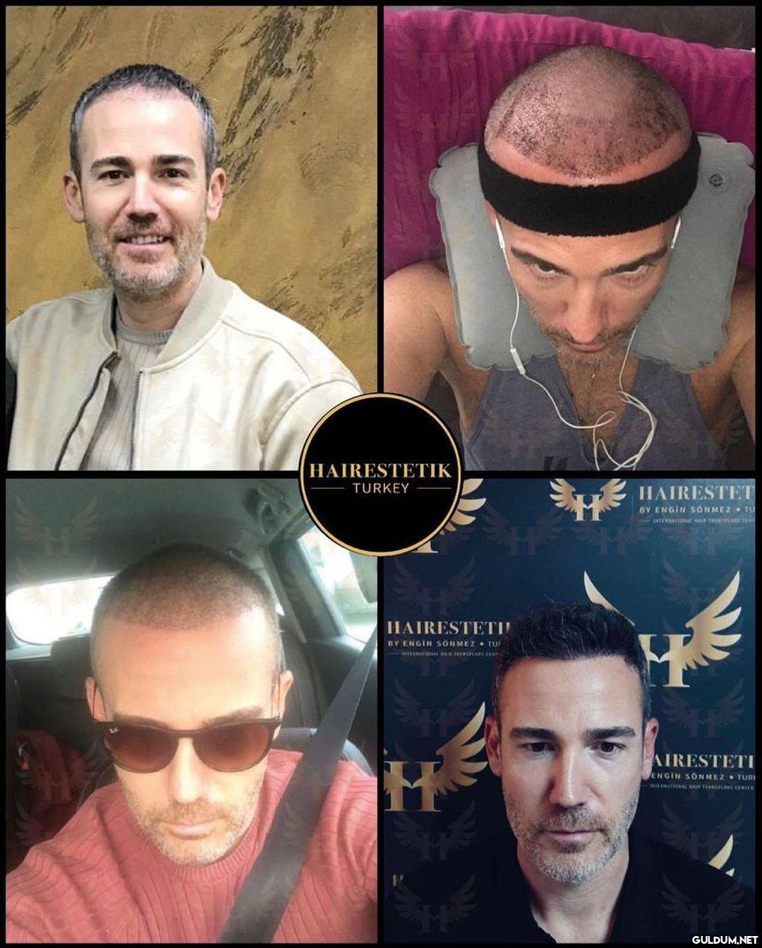 " @hairestetik Saphir Fue...