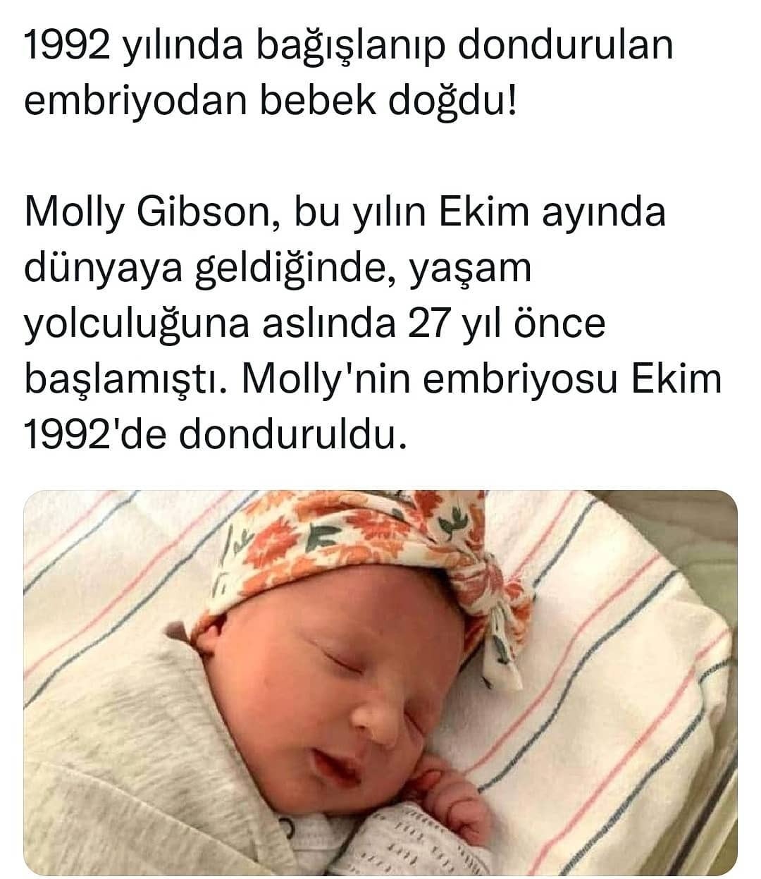 Sene 5000 mi neden...