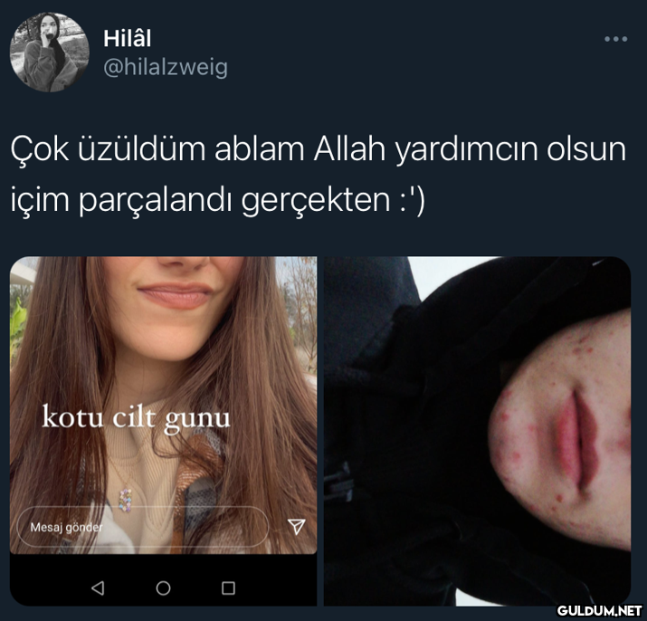 Hilâl @hilalzweig Çok...