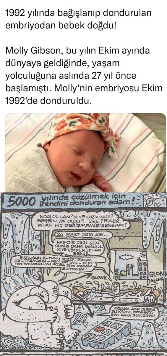 Sene 5000 mi neden...