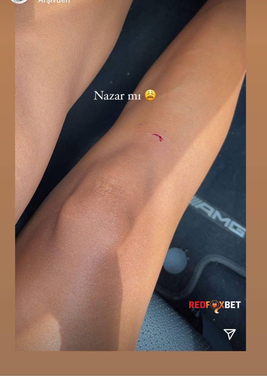 Nazar mı 9 AMG REDFOXBET    Kaynak
