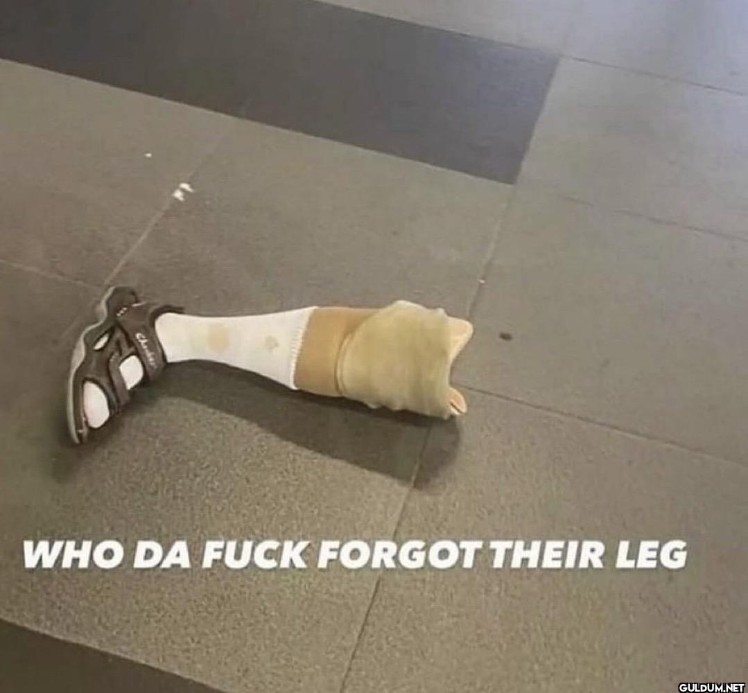 Check WHO DA FUCK FORGOT THEIR LEG