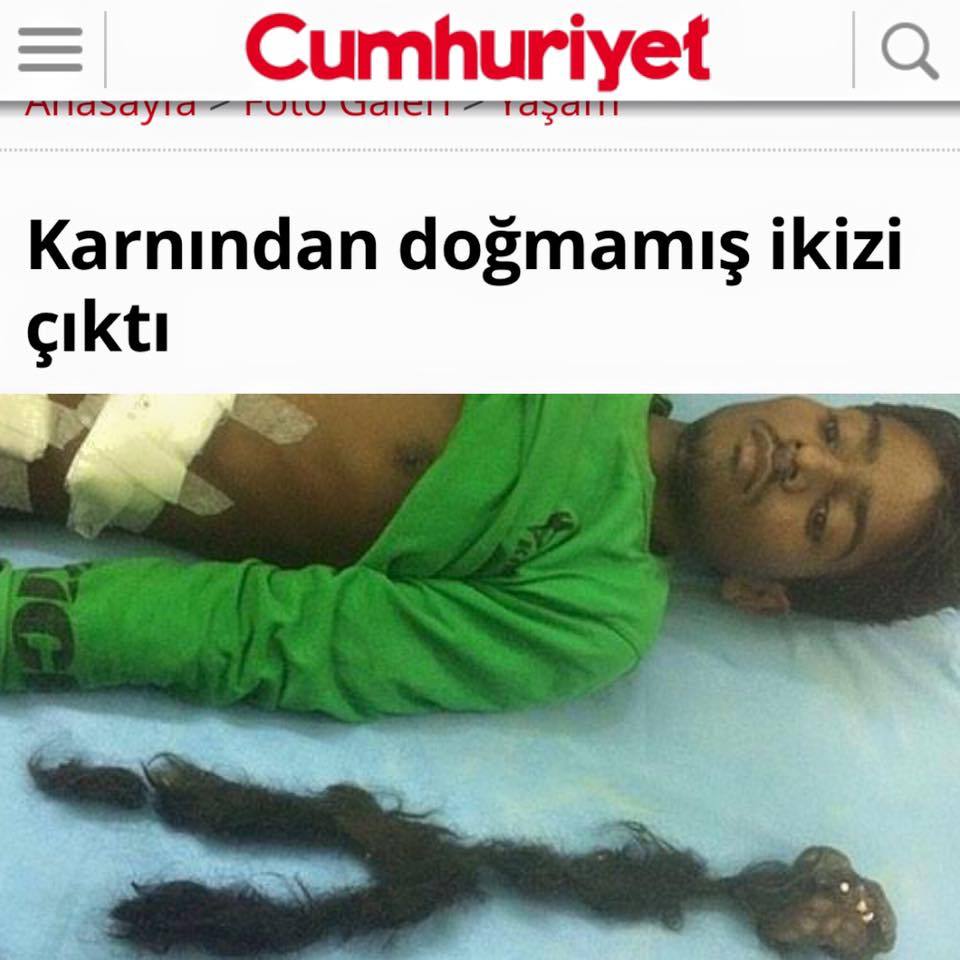 Cumhuriyet

 Karnından...