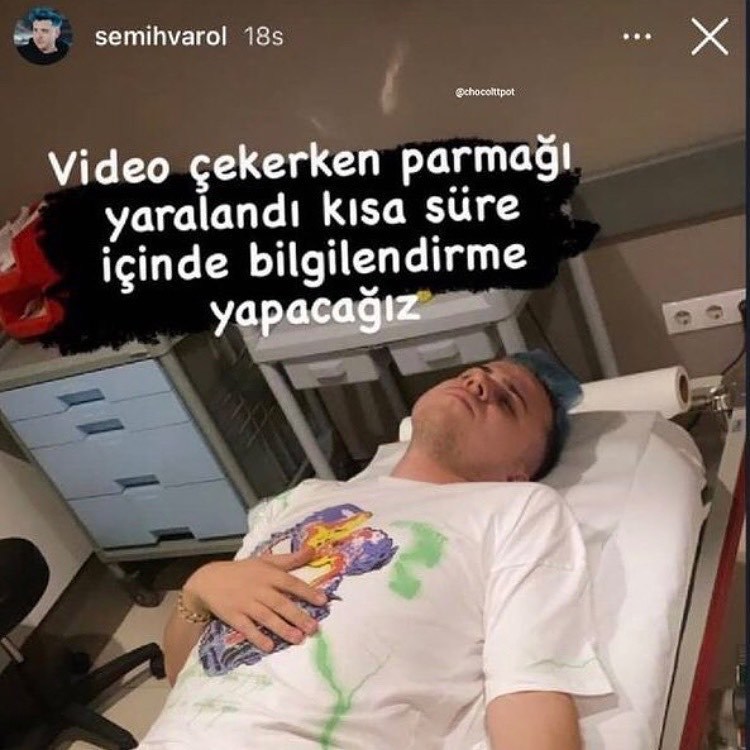 Benim abartma seviyesi  Kaynak