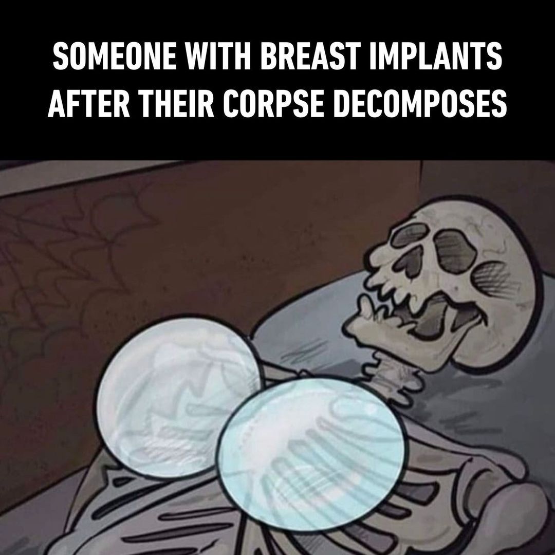 Hmm..🤔⠀ -⠀ #implants...