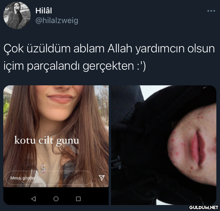 Hilâl @hilalzweig Çok...