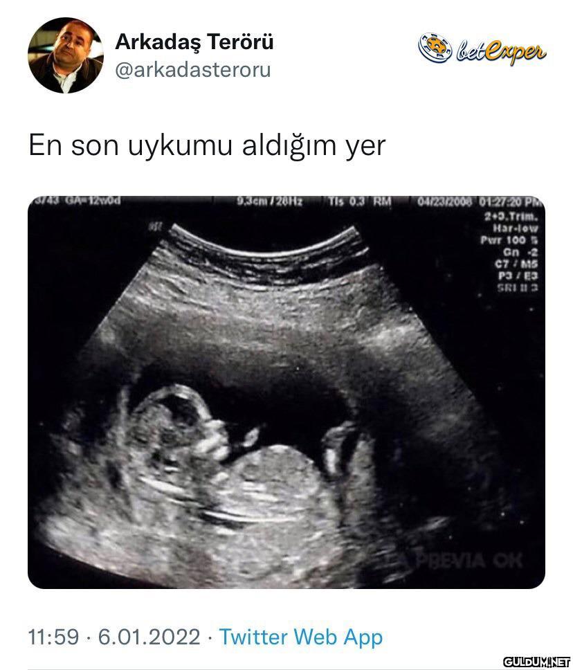 Aynen öyle    Arkadaş...
