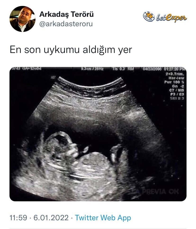 Aynen öyle    Arkadaş...