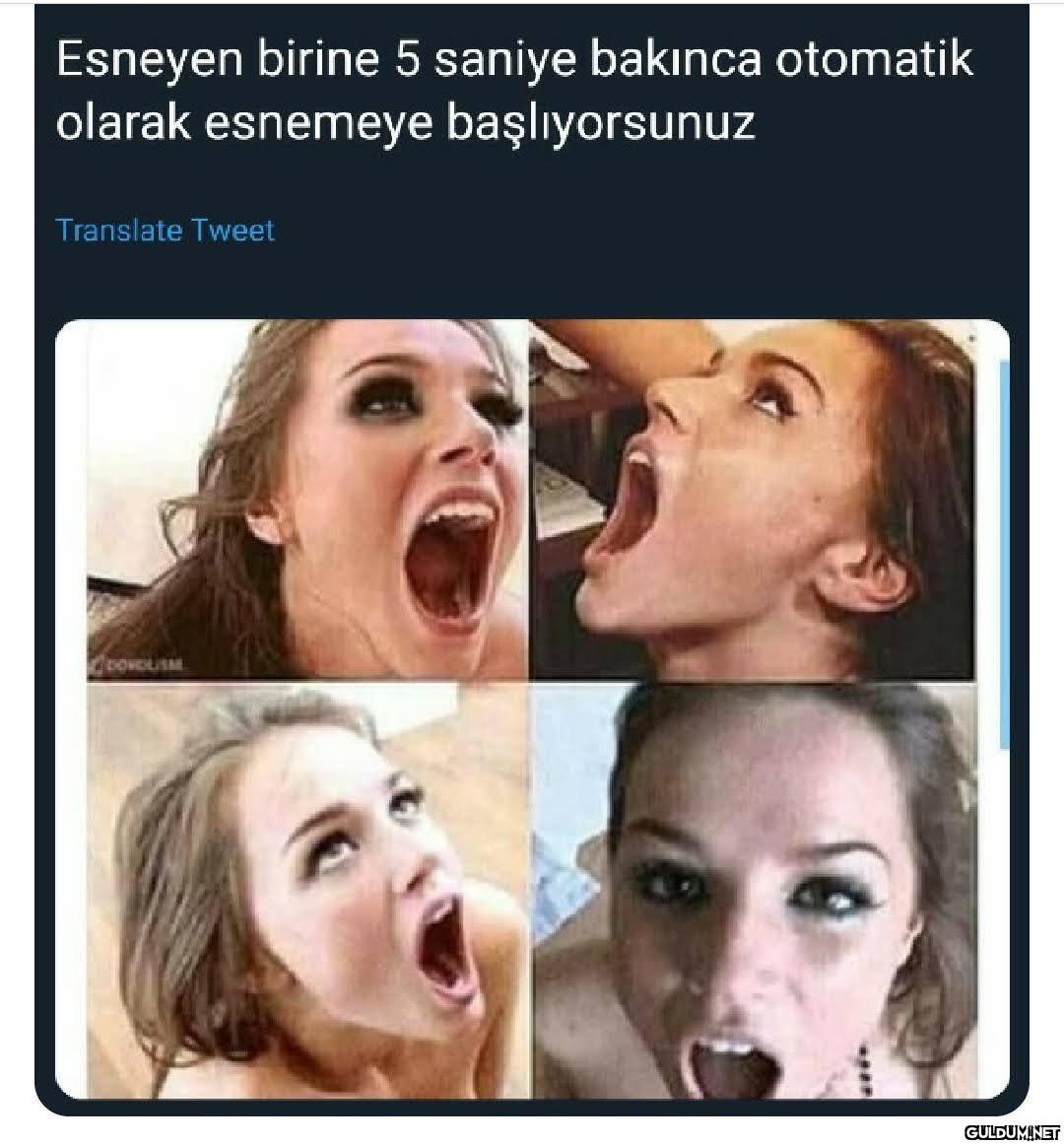 yawn...