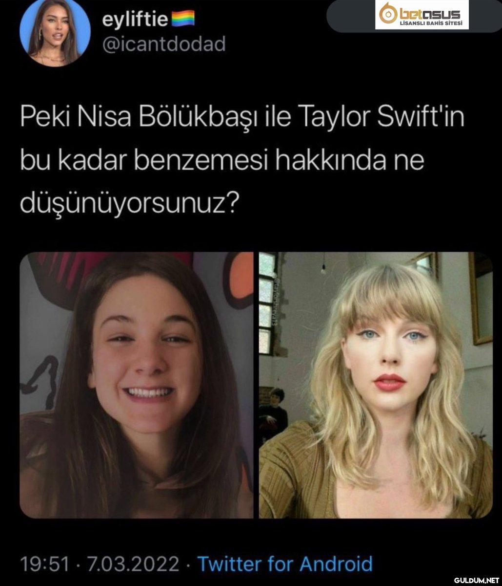 Gözlerinde bir bozukluk...
