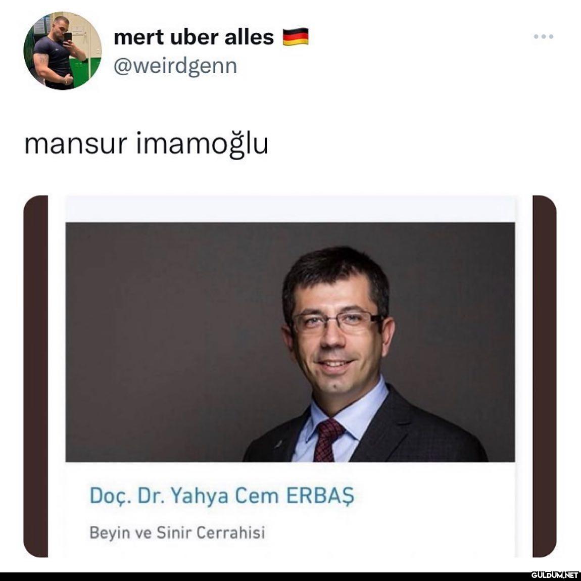 Beynim yandı  mert uber...