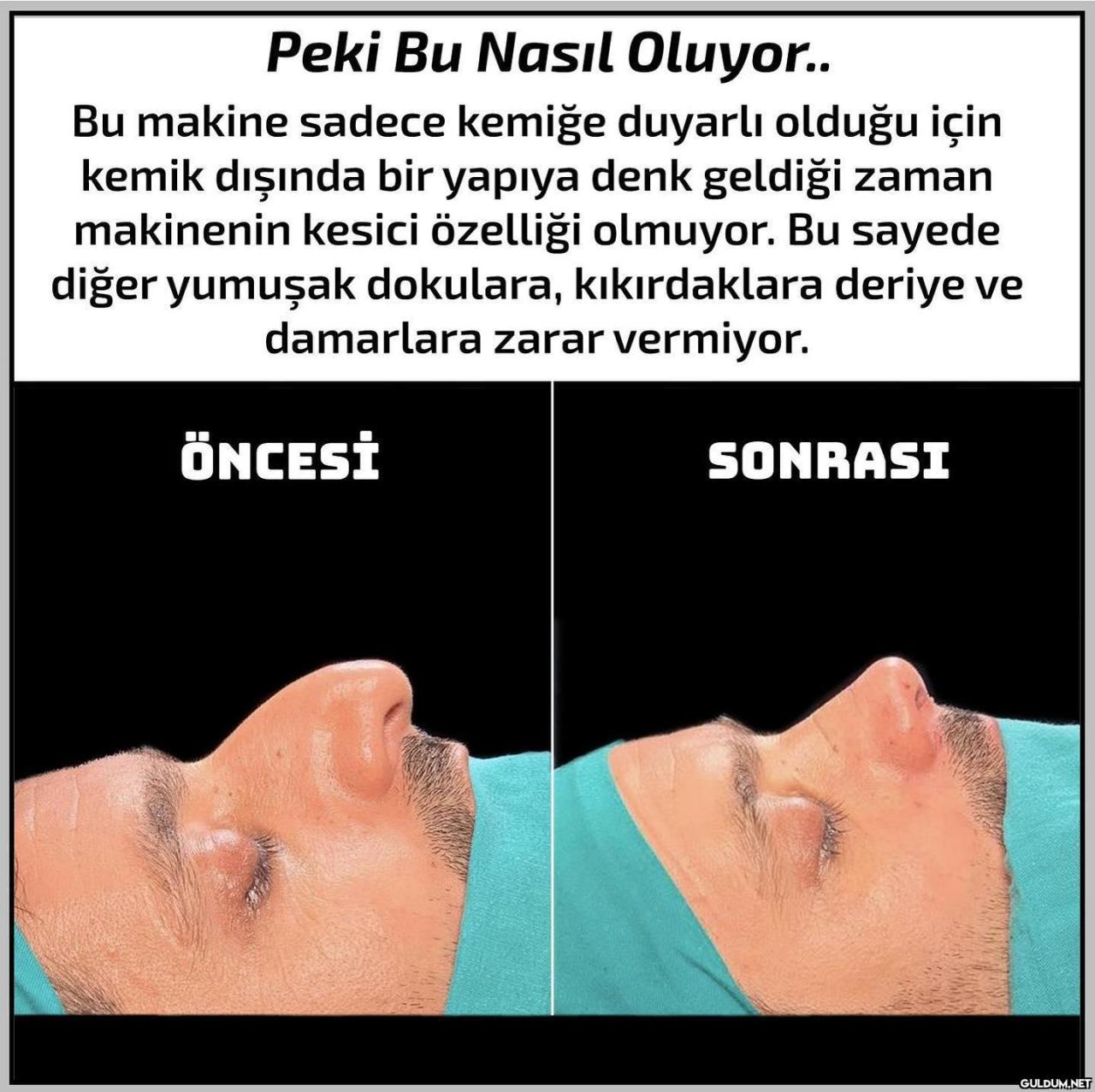 Arkadaşlar doktorun...