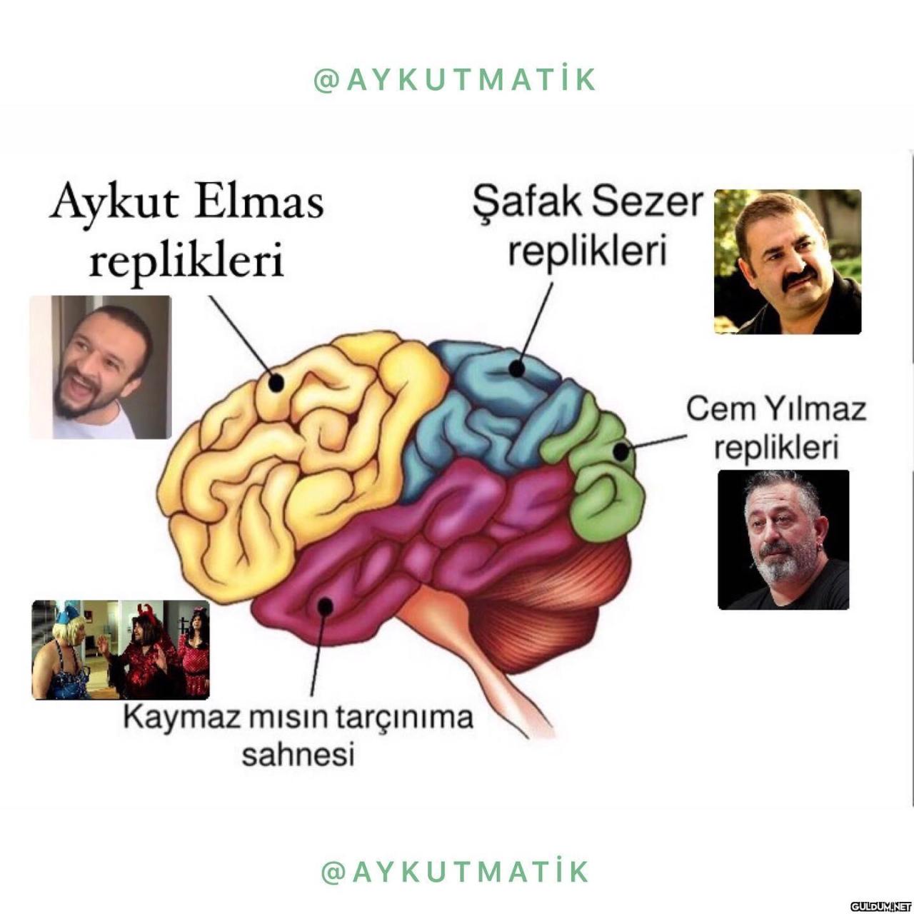 İdeal beyin tomografisi;  ...