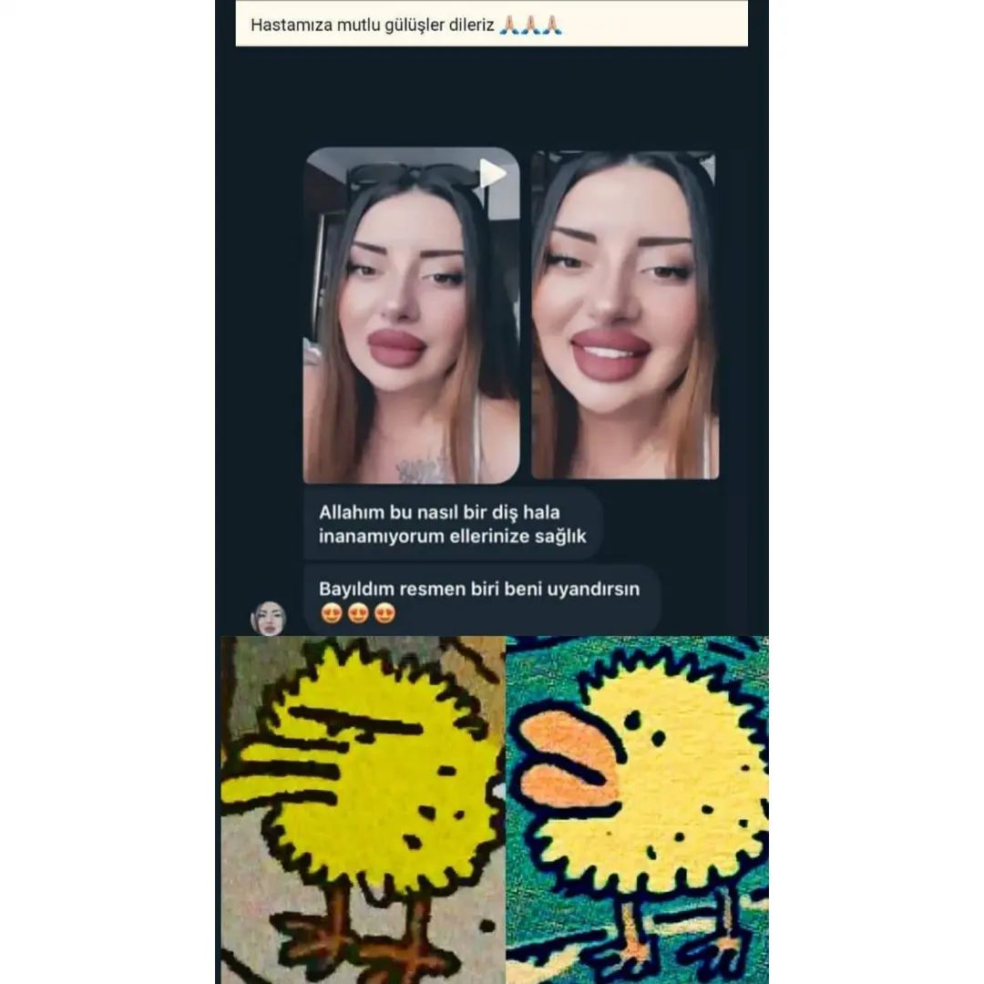 Fakat o dudaklar.....