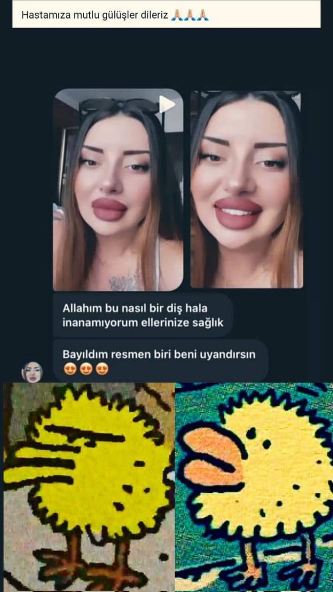 Fakat o dudaklar.....