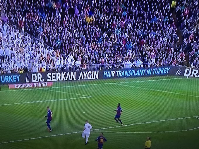 Türk saç ekim doktorunun...