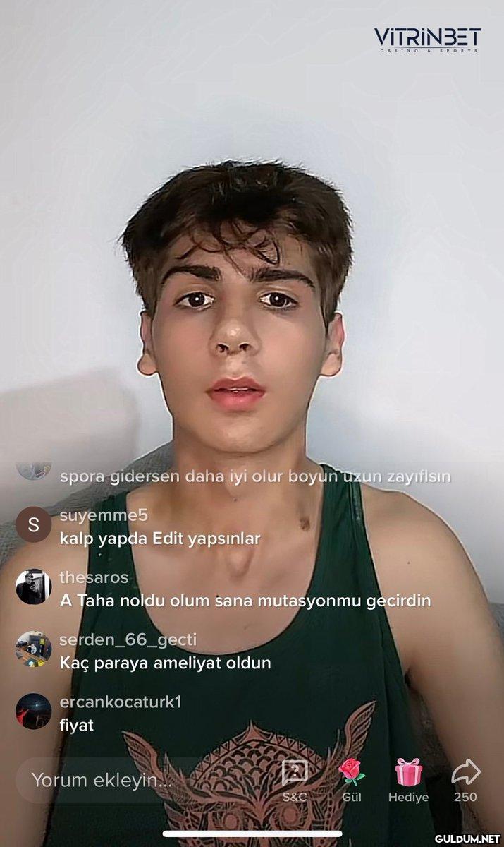 Lan ne olmuş buna...