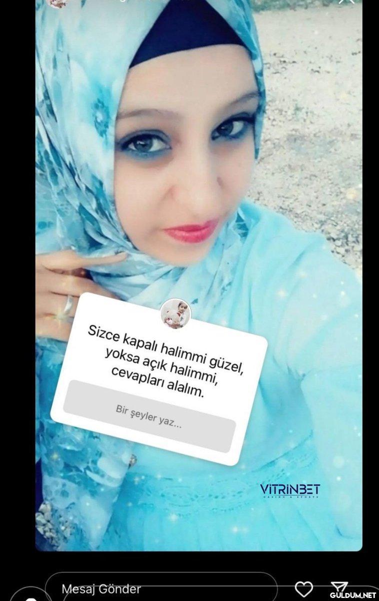 Ablam moda olsun diye mi...
